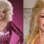 Dolly Parton Plastic Surgery Before And After Breast