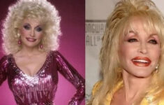 Dolly Parton Plastic Surgery Before And After Breast