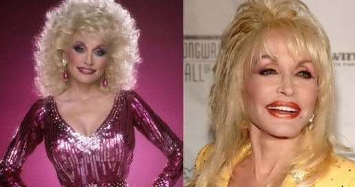 Dolly Parton Plastic Surgery Before And After Breast 