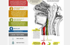 Handout Dysphagia Diet Textures Dysphagia Therapy