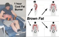 Pet Scan Diet Plan Pets Animals US