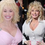 Pin On Dolly Parton Plastic Surgery
