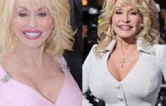 pin on dolly parton plastic surgery Pin On Dolly Parton Plastic Surgery