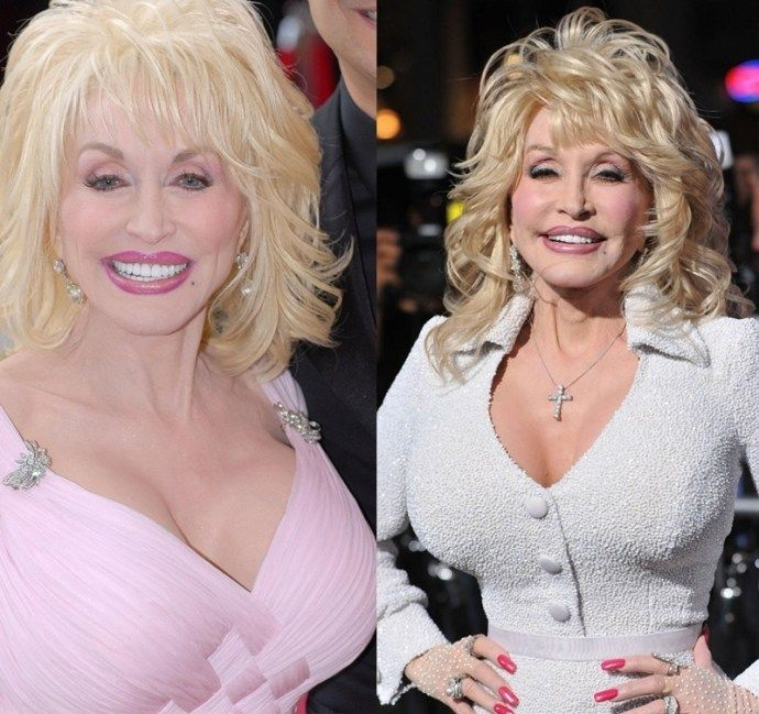 Pin On Dolly Parton Plastic Surgery